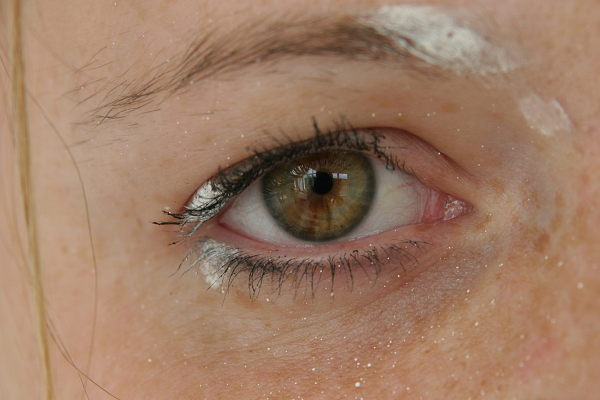 A white spot around the eye